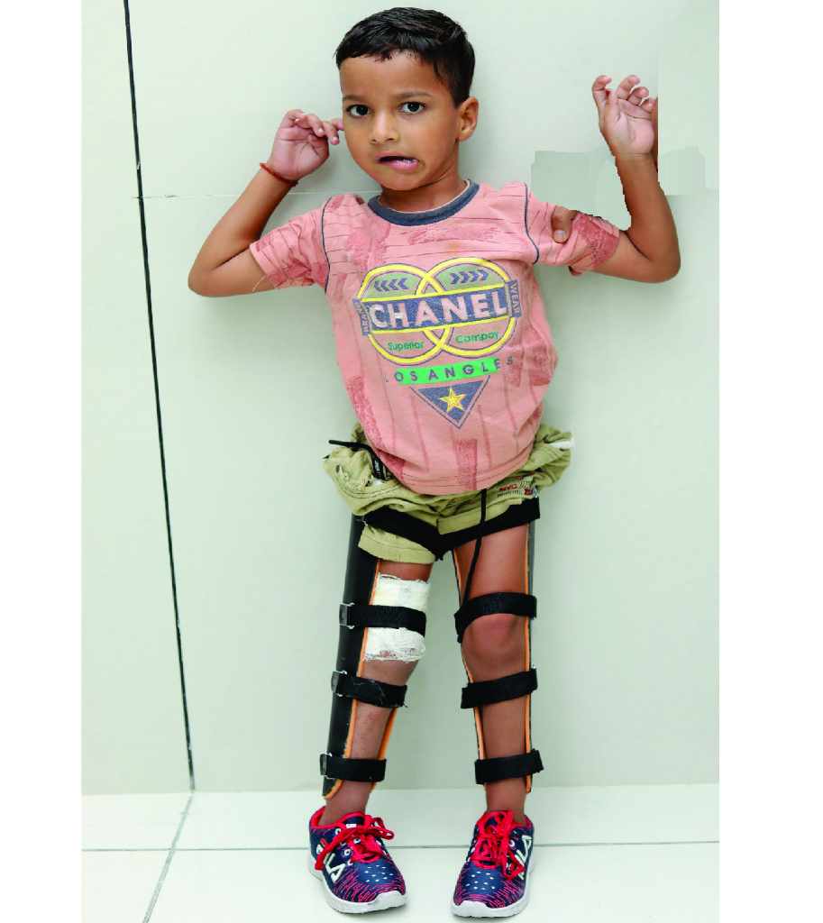 จันดู สิขวาล