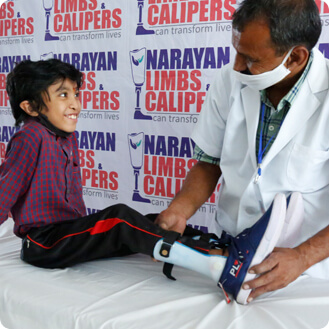 Artificial Limbs
