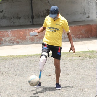 artificial limb